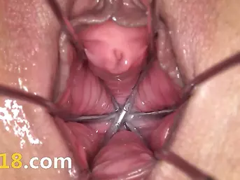 Gaping and gyno dildoing her graceful hole